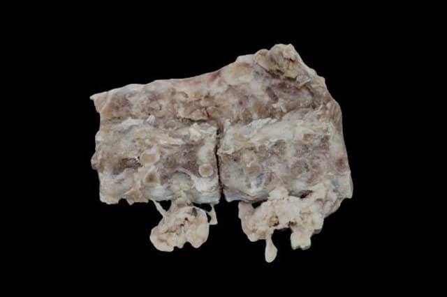 Huesos espinazo de cerdo salados (para cocidos) - Imagen 1