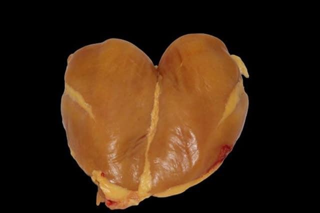 Pechugas de pollo - Imagen 1