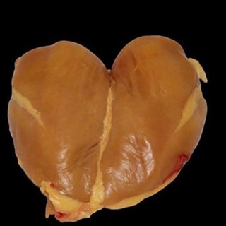 Pechugas de pollo - Imagen 1