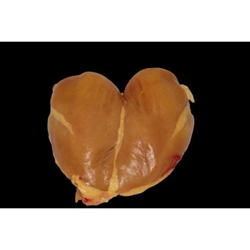 Pechugas de pollo - Imagen 1